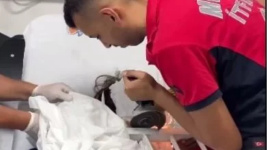 Mersin'de 7 yaşındaki çocuğun kafasına demir saplandı